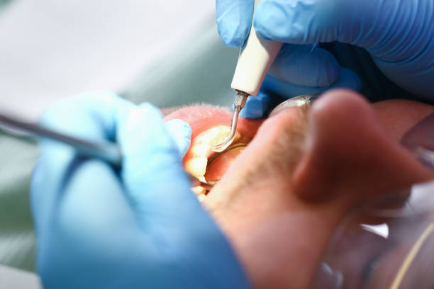 Best Weekend Emergency Dentist in Grandview, MO